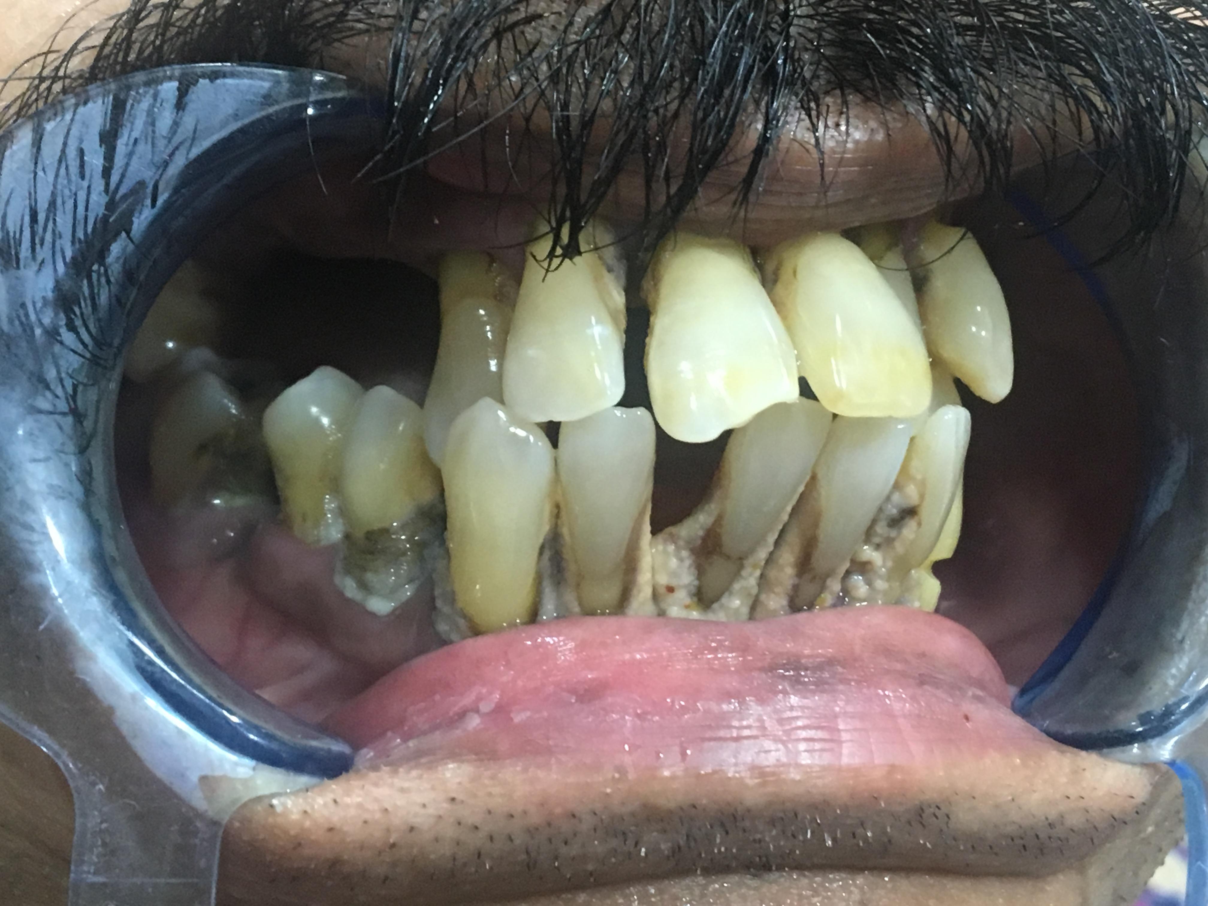 Before Image